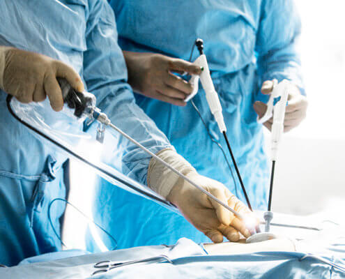 Bowel Injury During Laparoscopic Surgery